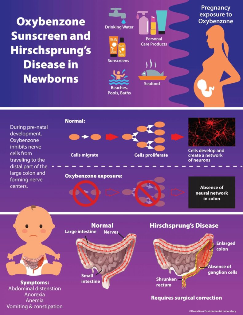 The Link Between Chemical Sunscreen And Hirschsprung’s Disease